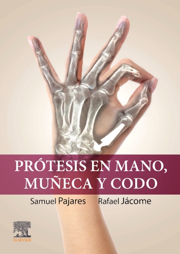 Prótesis en mano, muñeca y codo