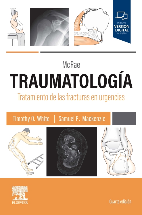 McRae. Traumatología. Tratamiento de las fracturas en urgencias