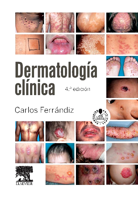 Dermatología clínica